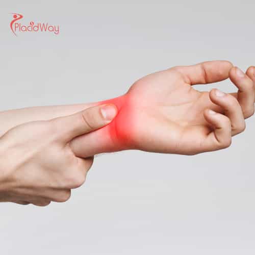 Puerto Vallarta’s Growth in Regenerative Medicine for Canadians with RA